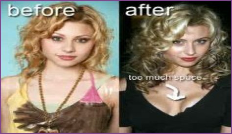 Aly Michalka Plastic Surgery Before and After